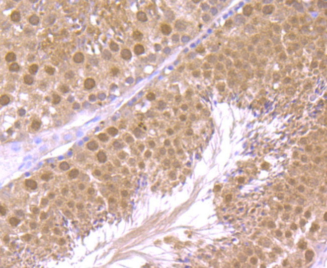 HMGB2 Antibody in Immunohistochemistry (Paraffin) (IHC (P))