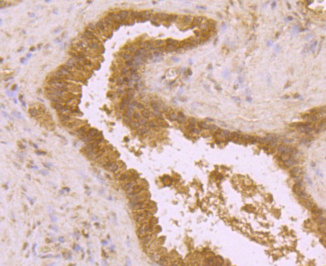 BMAL1 Antibody in Immunohistochemistry (Paraffin) (IHC (P))