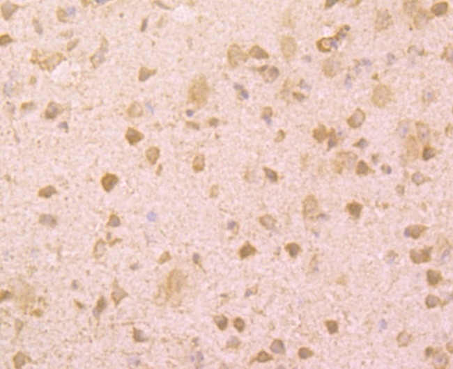 BMAL1 Antibody in Immunohistochemistry (Paraffin) (IHC (P))