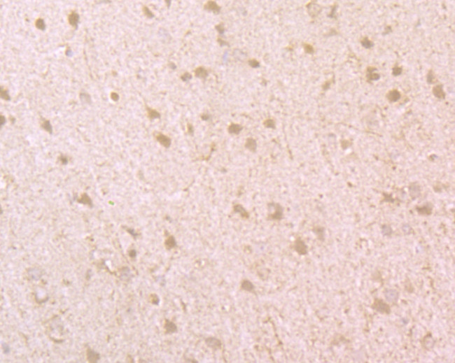 BMAL1 Antibody in Immunohistochemistry (Paraffin) (IHC (P))