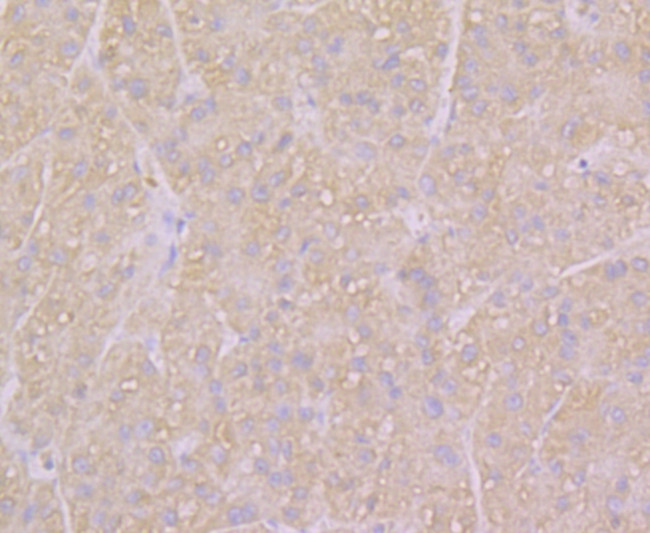 KCNK1 Antibody in Immunohistochemistry (Paraffin) (IHC (P))