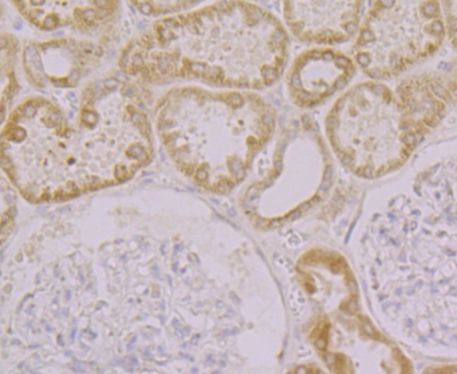 KCNK1 Antibody in Immunohistochemistry (Paraffin) (IHC (P))