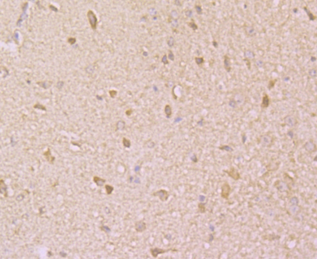 KCNK1 Antibody in Immunohistochemistry (Paraffin) (IHC (P))