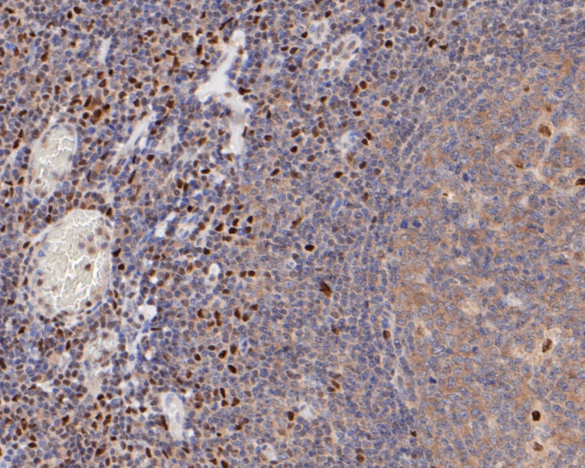 FOXP1 Antibody in Immunohistochemistry (Paraffin) (IHC (P))