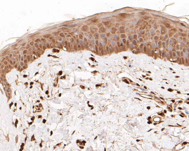 FOXP1 Antibody in Immunohistochemistry (Paraffin) (IHC (P))