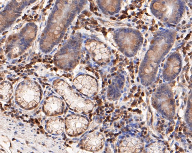 FOXP1 Antibody in Immunohistochemistry (Paraffin) (IHC (P))