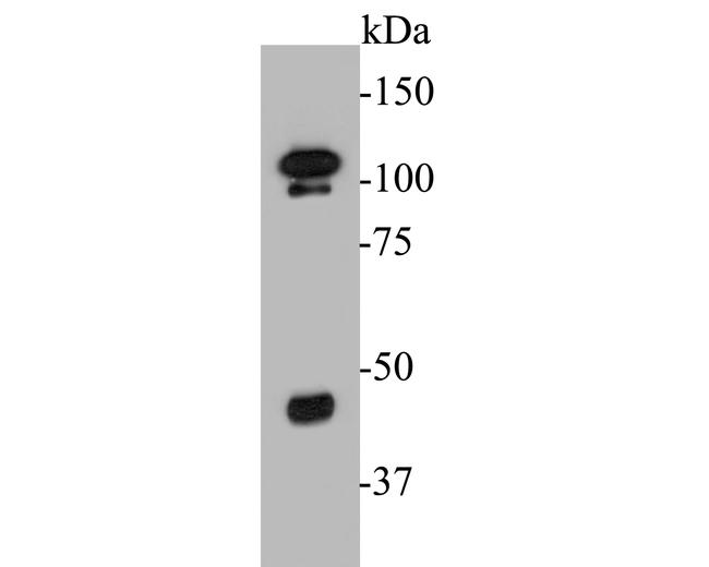 FOXP1 Antibody in Western Blot (WB)