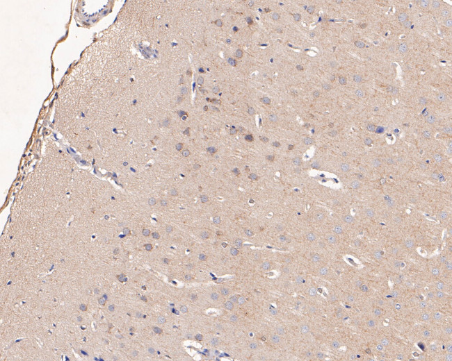 LGI1 Antibody in Immunohistochemistry (Paraffin) (IHC (P))