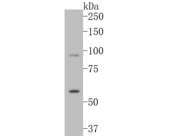 LGI1 Antibody in Western Blot (WB)