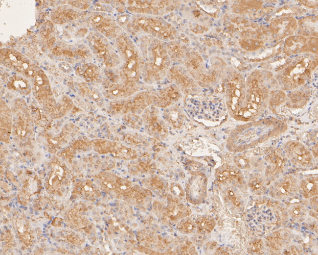 DNA2 Antibody in Immunohistochemistry (Paraffin) (IHC (P))