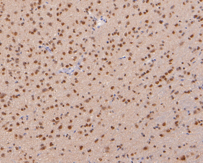 COPS8 Antibody in Immunohistochemistry (Paraffin) (IHC (P))