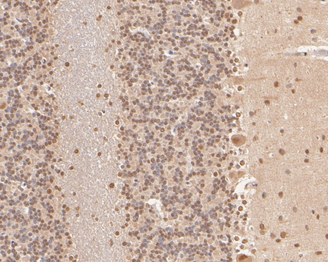 COPS8 Antibody in Immunohistochemistry (Paraffin) (IHC (P))