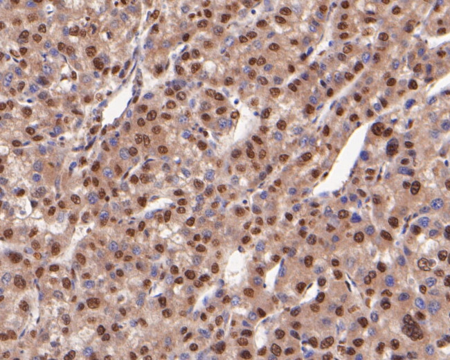 COPS8 Antibody in Immunohistochemistry (Paraffin) (IHC (P))