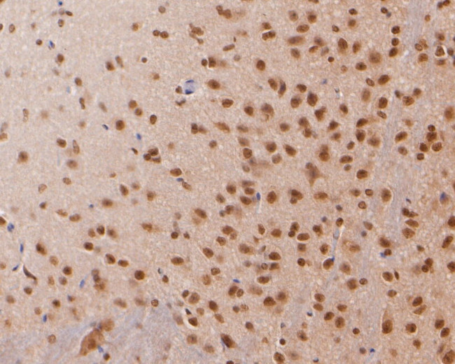 COPS8 Antibody in Immunohistochemistry (Paraffin) (IHC (P))