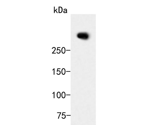 ZFHX3 Antibody in Western Blot (WB)