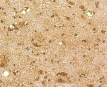 SIRT6 Antibody in Immunohistochemistry (Paraffin) (IHC (P))