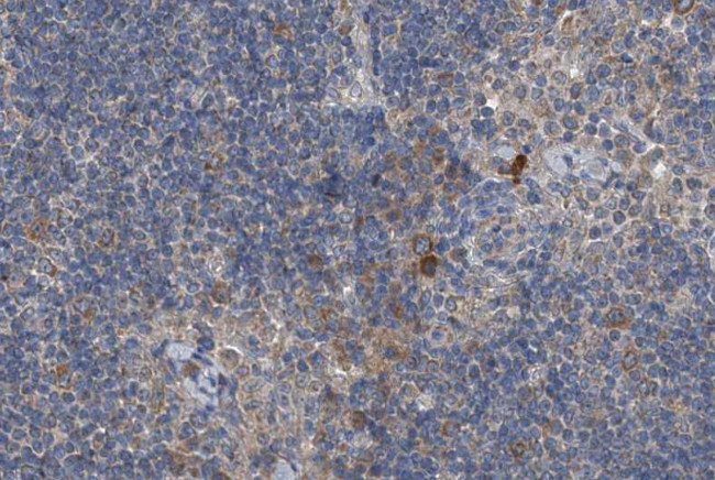 Phospho-RIP2 (Ser176) Antibody in Immunohistochemistry (Paraffin) (IHC (P))