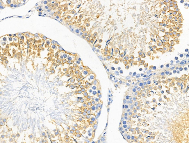 Dysferlin Antibody in Immunohistochemistry (Paraffin) (IHC (P))