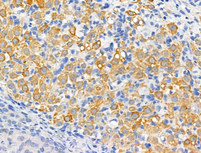 Dysferlin Antibody in Immunohistochemistry (Paraffin) (IHC (P))