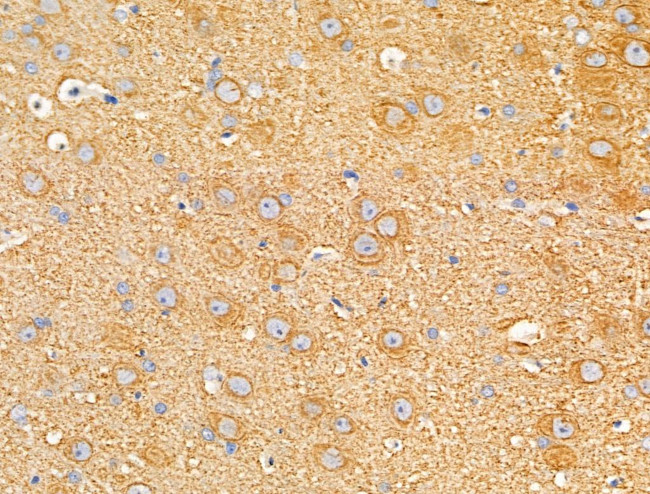 Dysferlin Antibody in Immunohistochemistry (Paraffin) (IHC (P))