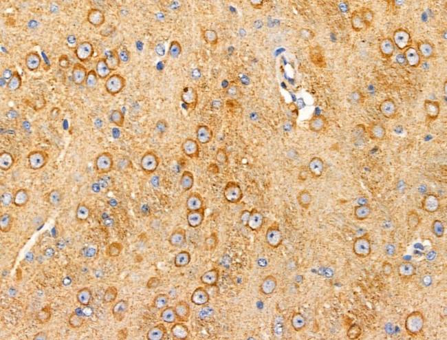 Dysferlin Antibody in Immunohistochemistry (Paraffin) (IHC (P))