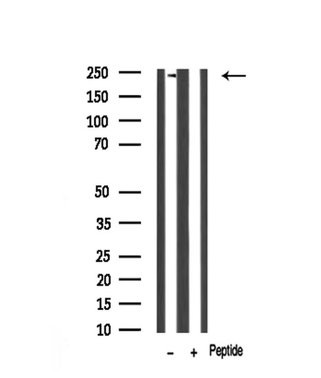 Dysferlin Antibody in Western Blot (WB)