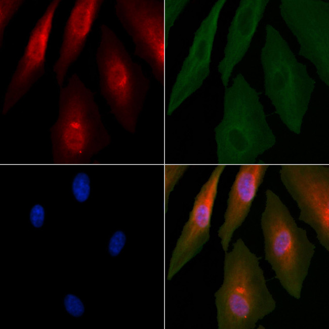 UBA52 Antibody in Immunocytochemistry (ICC/IF)