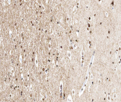 UBA52 Antibody in Immunohistochemistry (Paraffin) (IHC (P))