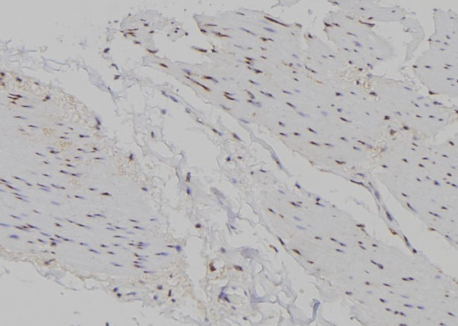 MSC Antibody in Immunohistochemistry (Paraffin) (IHC (P))