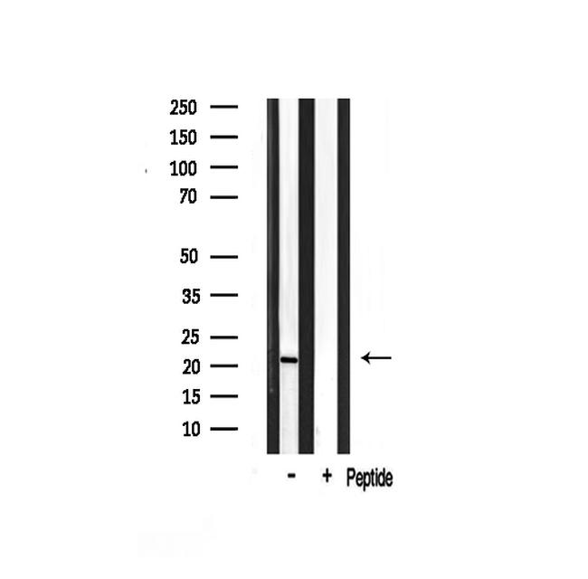 MSC Antibody in Western Blot (WB)