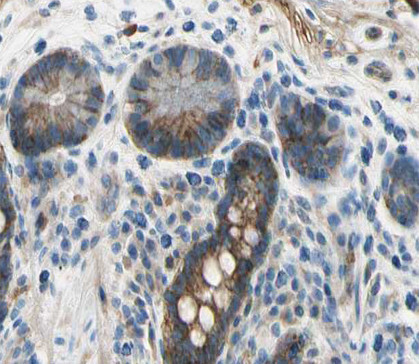 APRIL Antibody in Immunohistochemistry (Paraffin) (IHC (P))