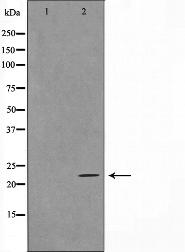 APRIL Antibody in Western Blot (WB)