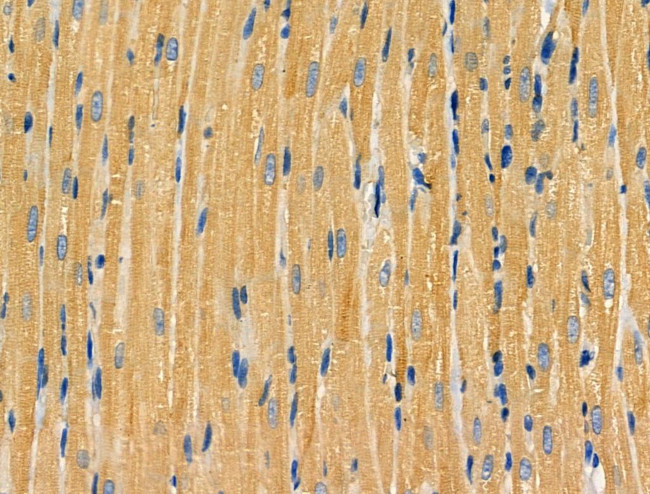 NAA15 Antibody in Immunohistochemistry (Paraffin) (IHC (P))