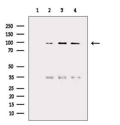 NAA15 Antibody in Western Blot (WB)