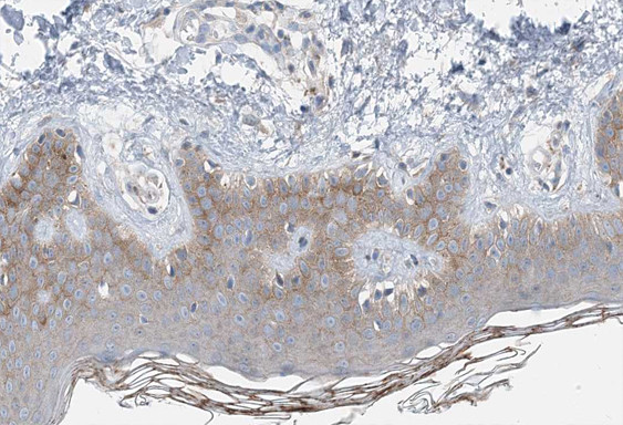 COL14A1 Antibody in Immunohistochemistry (Paraffin) (IHC (P))