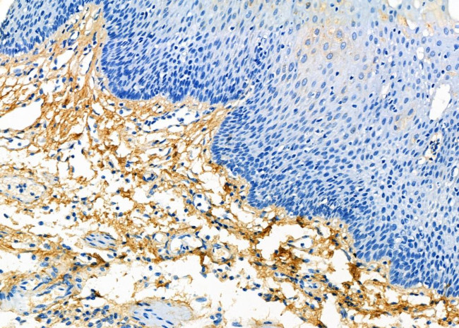 COL14A1 Antibody in Immunohistochemistry (Paraffin) (IHC (P))