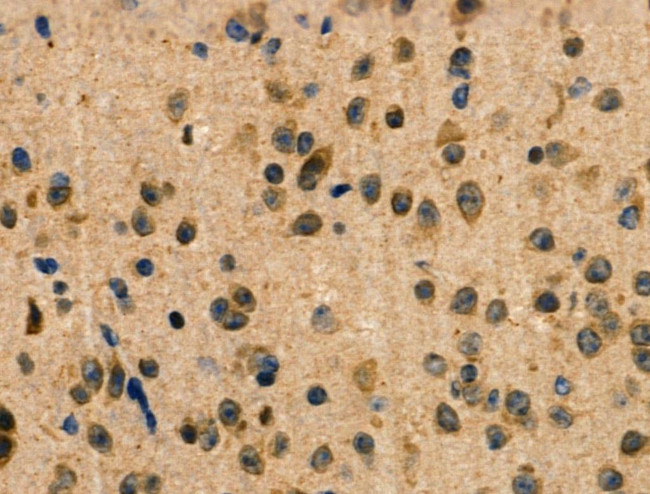 RBM26 Antibody in Immunohistochemistry (Paraffin) (IHC (P))