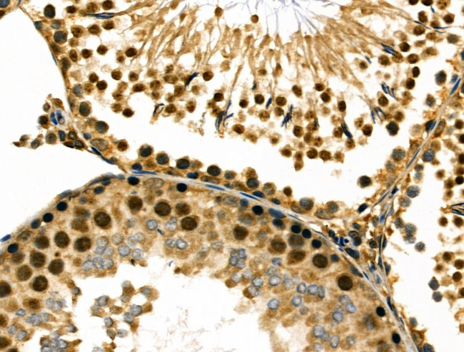 RBM26 Antibody in Immunohistochemistry (Paraffin) (IHC (P))