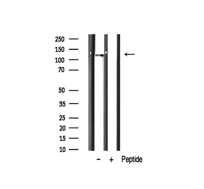 RBM26 Antibody in Western Blot (WB)