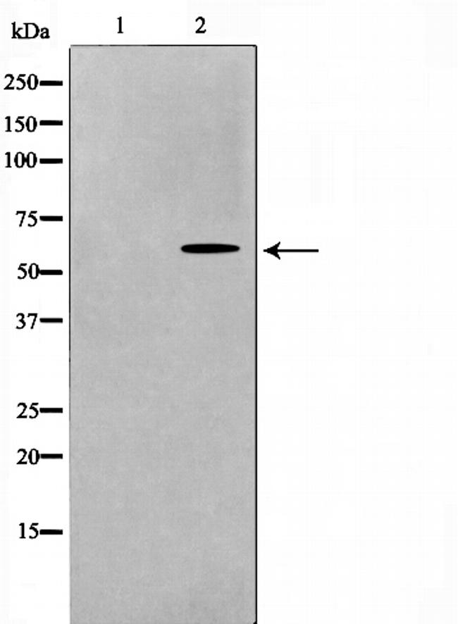 RAD18 Antibody in Western Blot (WB)