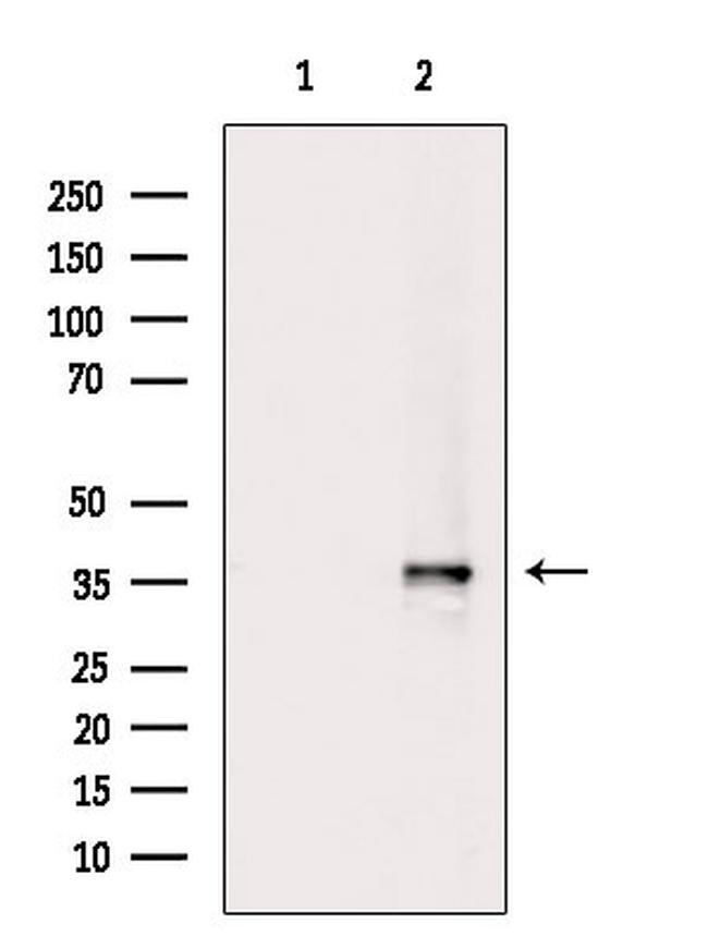 Phospho-CDK6 (Tyr13) Antibody in Western Blot (WB)