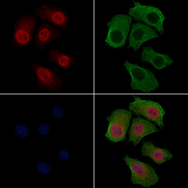 Phospho-FOXO3A (Ser253) Antibody in Immunocytochemistry (ICC/IF)