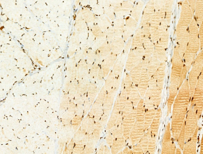 Phospho-FOXO3A (Ser253) Antibody in Immunohistochemistry (Paraffin) (IHC (P))