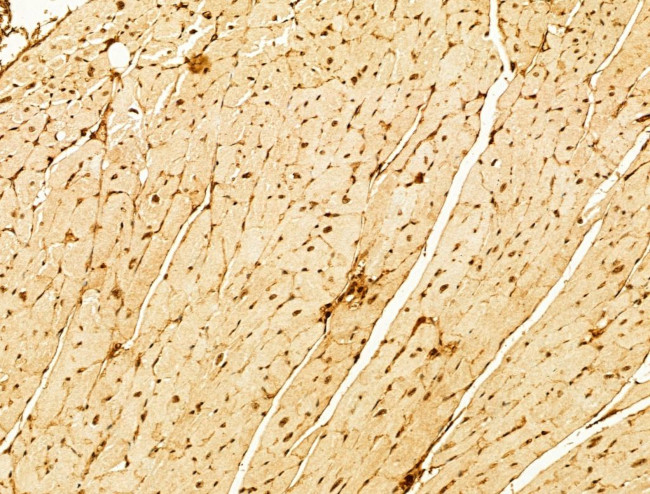 Phospho-FOXO3A (Ser253) Antibody in Immunohistochemistry (Paraffin) (IHC (P))