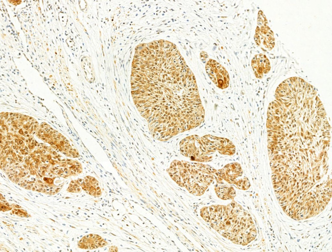 Phospho-FOXO3A (Ser253) Antibody in Immunohistochemistry (Paraffin) (IHC (P))