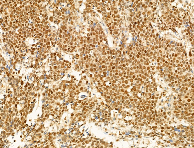 Phospho-FOXO3A (Ser253) Antibody in Immunohistochemistry (Paraffin) (IHC (P))