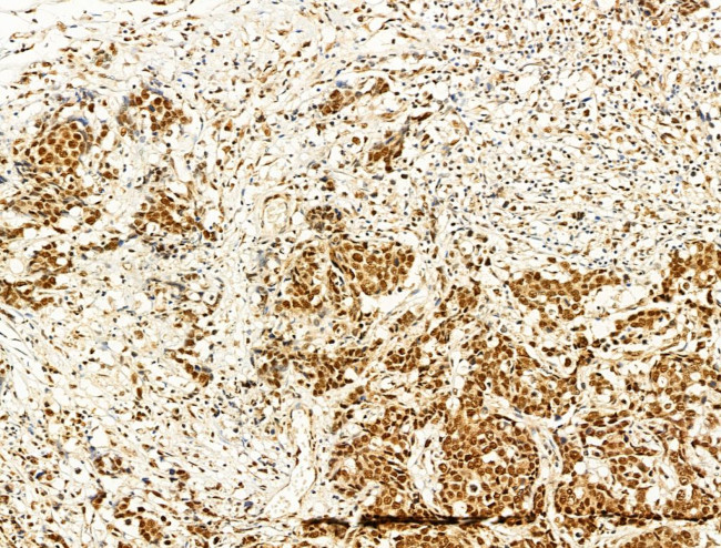 Phospho-FOXO3A (Ser253) Antibody in Immunohistochemistry (Paraffin) (IHC (P))