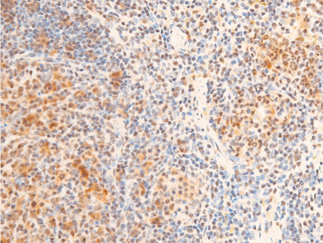 Phospho-FOXO3A (Ser253) Antibody in Immunohistochemistry (Paraffin) (IHC (P))