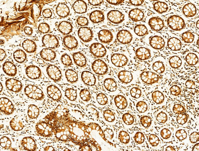 Phospho-FOXO3A (Ser253) Antibody in Immunohistochemistry (Paraffin) (IHC (P))