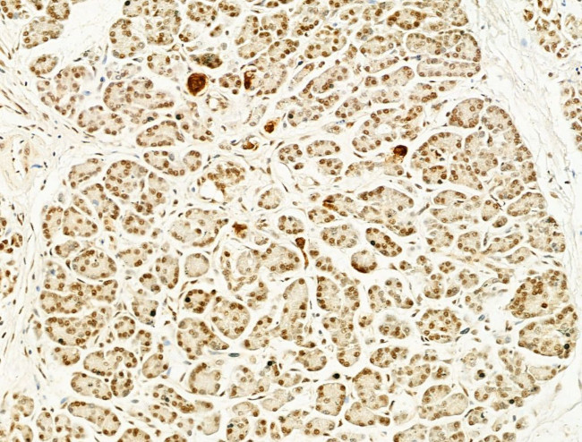 Phospho-FOXO3A (Ser253) Antibody in Immunohistochemistry (Paraffin) (IHC (P))